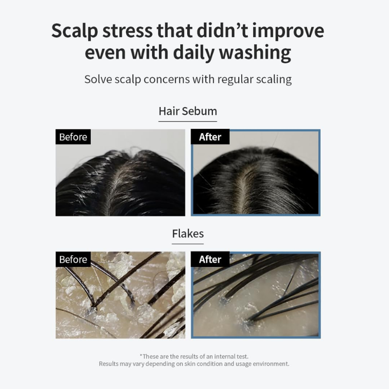 GROWUS Sea Salt Therapy Scalp Scaler 120g